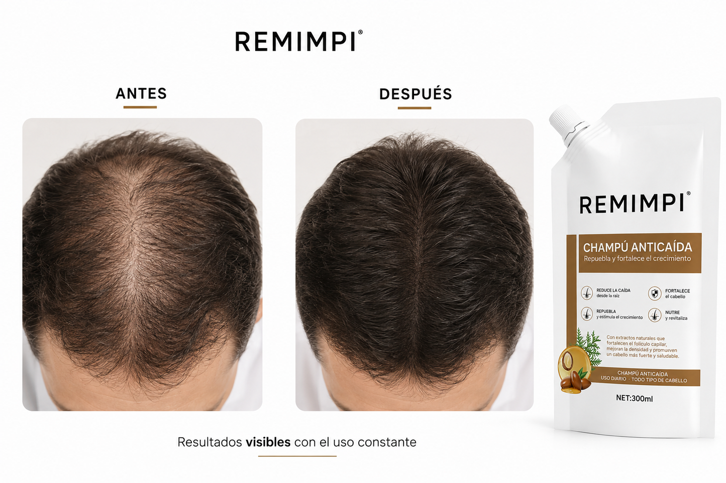 shampoo anti caida 100% Efectivo
