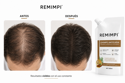 shampoo anti caida 100% Efectivo