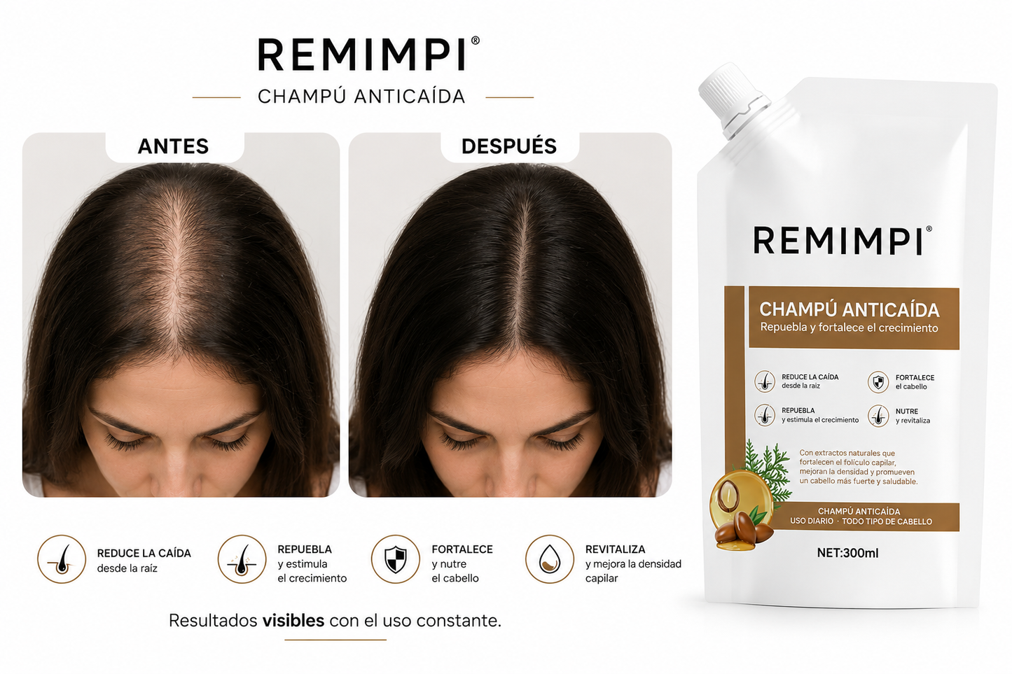 shampoo anti caida 100% Efectivo